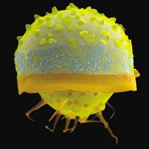 单细胞硅藻土